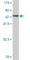 PEPD Antibody (monoclonal) (M01)