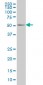 PEPD Antibody (monoclonal) (M01)