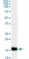 PF4 Antibody (monoclonal) (M01)