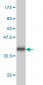 PF4 Antibody (monoclonal) (M01)