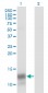 PF4 Antibody (monoclonal) (M01)