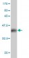 PFN2 Antibody (monoclonal) (M04)
