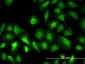 PGM1 Antibody (monoclonal) (M01)