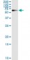 PGM1 Antibody (monoclonal) (M01)