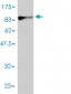 PGM1 Antibody (monoclonal) (M01)