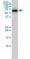 PGM1 Antibody (monoclonal) (M01)