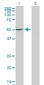 PGM1 Antibody (monoclonal) (M01)