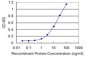 PGM1 Antibody (monoclonal) (M01)