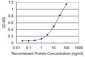 PGM1 Antibody (monoclonal) (M01)