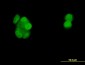 PGR Antibody (monoclonal) (M01)