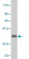 PGR Antibody (monoclonal) (M01)