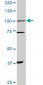 PGR Antibody (monoclonal) (M01)