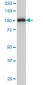 PGR Antibody (monoclonal) (M01)