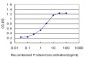 PGR Antibody (monoclonal) (M01)