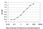 PGR Antibody (monoclonal) (M04)