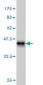 PGR Antibody (monoclonal) (M04)
