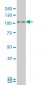 PGR Antibody (monoclonal) (M04)