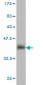 PGR Antibody (monoclonal) (M05)