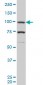 PGR Antibody (monoclonal) (M05)