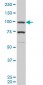 PGR Antibody (monoclonal) (M05)