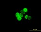 PGR Antibody (monoclonal) (M07)