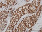 PGR Antibody (monoclonal) (M07)