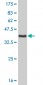PGR Antibody (monoclonal) (M07)
