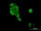PGR Antibody (monoclonal) (M08)