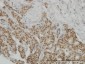 PGR Antibody (monoclonal) (M08)