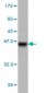 PGR Antibody (monoclonal) (M08)