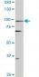 PGR Antibody (monoclonal) (M08)