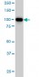 PGR Antibody (monoclonal) (M08)