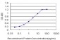 PGR Antibody (monoclonal) (M08)