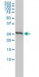 PHB Antibody (monoclonal) (M01)