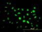 PHF1 Antibody (monoclonal) (M04)