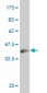 PHF1 Antibody (monoclonal) (M04)