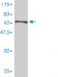 PHGDH Antibody (monoclonal) (M01)