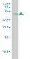 PHGDH Antibody (monoclonal) (M01)