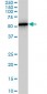 PHGDH Antibody (monoclonal) (M01)