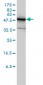 PHGDH Antibody (monoclonal) (M01)