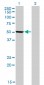 PHGDH Antibody (monoclonal) (M01)