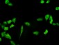 PHGDH Antibody (monoclonal) (M01)