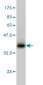 PHOSPHO1 Antibody (monoclonal) (M04)