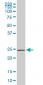 PHOSPHO1 Antibody (monoclonal) (M04)