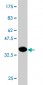 PHOSPHO1 Antibody (monoclonal) (M10)