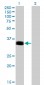 PHOX2A Antibody (monoclonal) (M01)