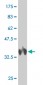 PI15 Antibody (monoclonal) (M02)