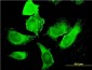 PIP5K3 Antibody (monoclonal) (M01)