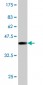 PIP5K3 Antibody (monoclonal) (M01)