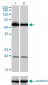 PIP5K3 Antibody (monoclonal) (M01)